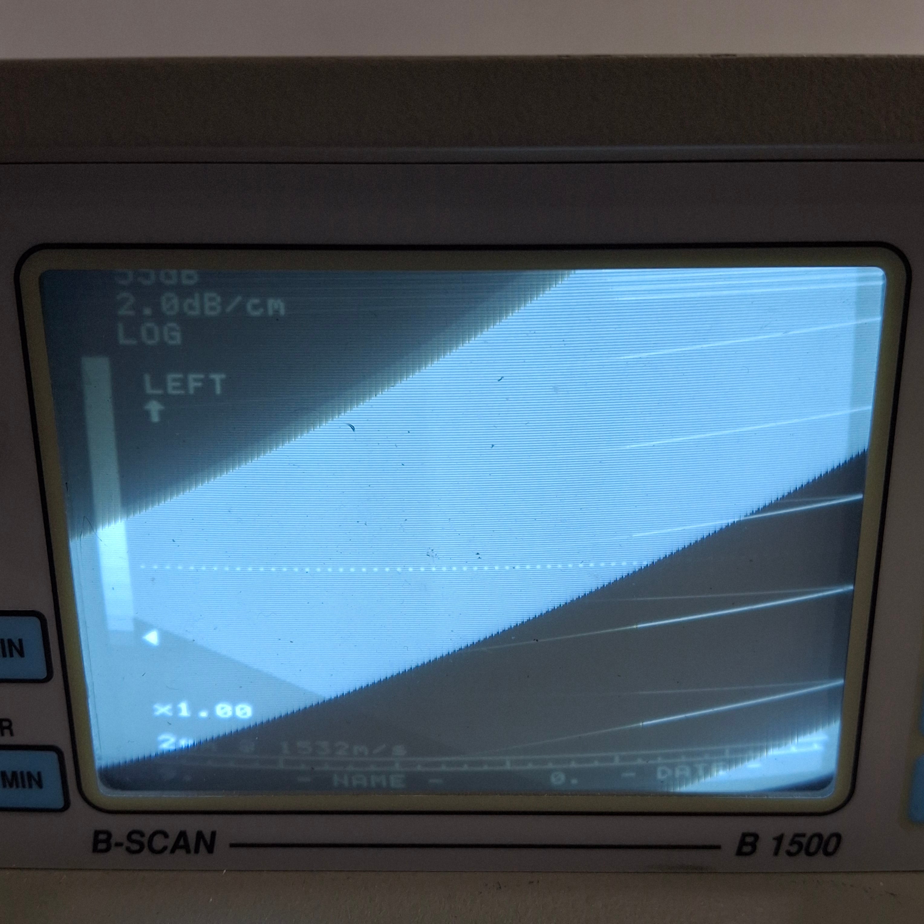 Sonomed Escalon B-Scan 1500 Ophthalmic Ultrasound
