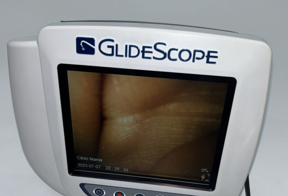 Verathon Glidescope AVL Video Laryngoscope System w/ Baton 0570-0307 0570-0304