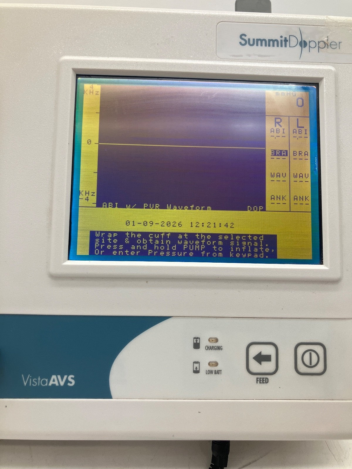 Summit Doppler Vista AVS Advanced Vascular System W Power Supply + Accessories