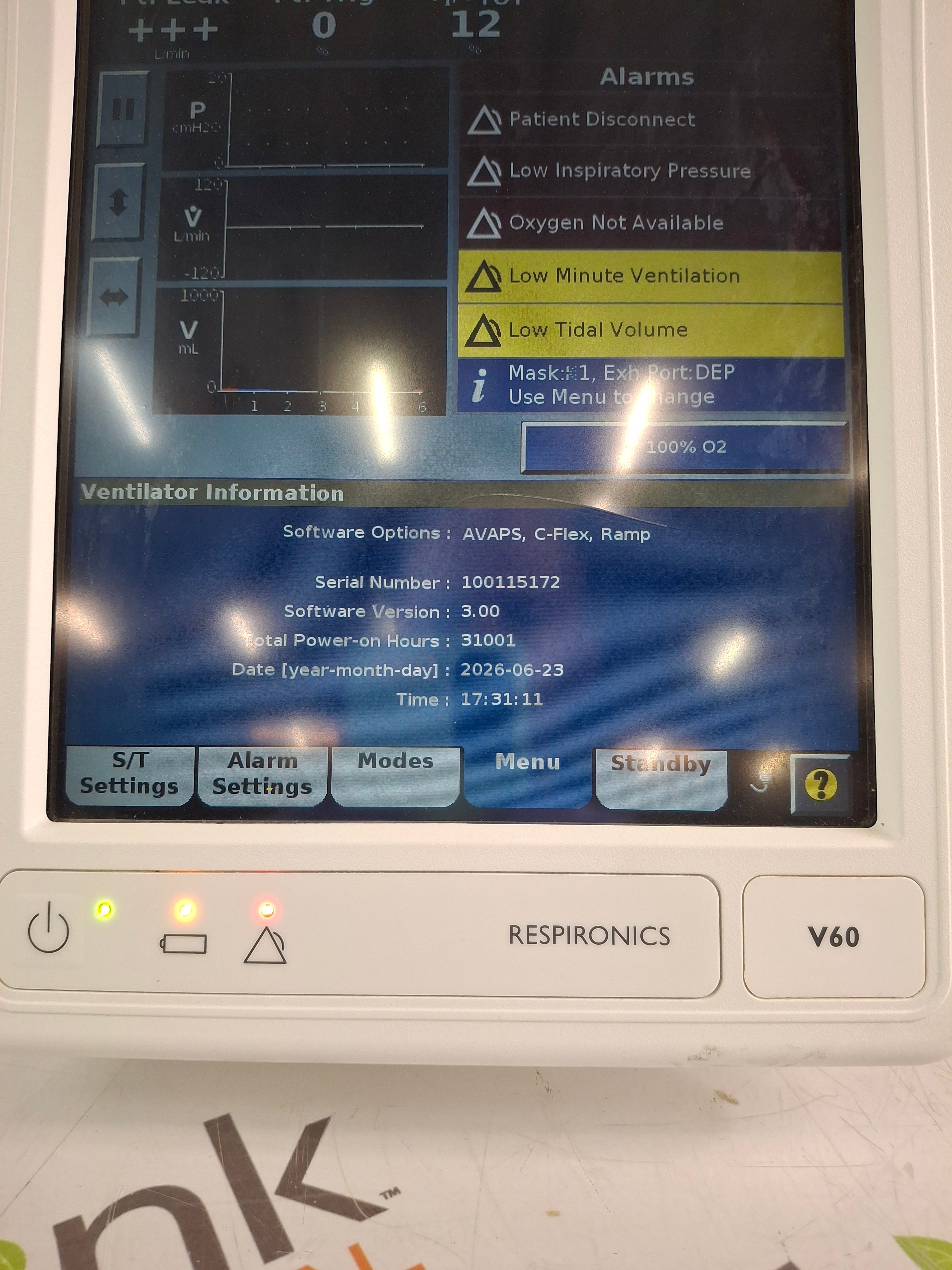 Respironics V60 BiPAP Ventilator Monitor